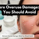 Skincare Overuse Damage: What You Should Avoid