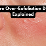 Skincare Over-Exfoliation Damage Explained