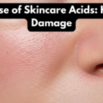 Overuse of Skincare Acids: Hidden Damage